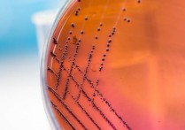 什麼是無氧或無氧呼吸？概念、特徵、存在類型以及範例