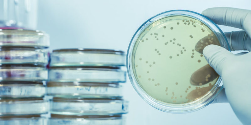 什麼是微生物學？概念、特徵、研究分支、重要性、分類及歷史