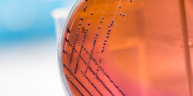 什麼是無氧或無氧呼吸？概念、特徵、存在類型以及範例
